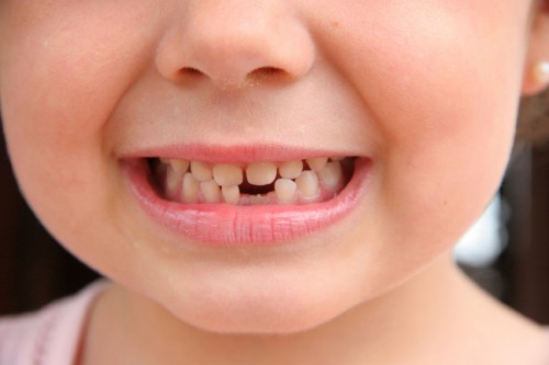 A child with a growing new tooth